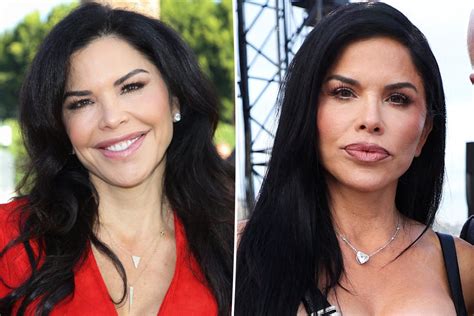 Lauren Sanchez Before and After Plastic Surgery